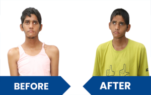 snehalaya-bhavanisingh-rescue-01Dec2024-02