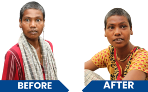 snehalaya-chikichandni-rescue-07dec2024-02