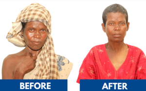 snehalaya-kunee-rescue-20dec2024-02