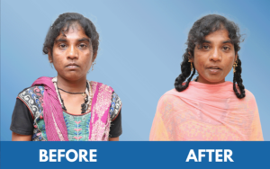 snehalaya-laxmi-rescue-22janc2025-06