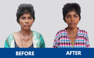 snehalaya-sunitha-rescue-25jan2025-05