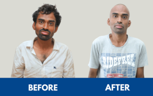 snehalaya-vikram-rescue-11feb2025-00