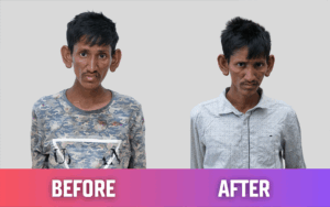 snehalaya-sunil-rescue-21JUN2025-04