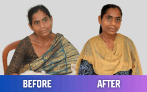 snehalaya-rajuni-rescue-15july2025-05.