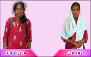 snehalaya-amuda-rescue-12jan2026-10.